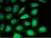 如何快速找回之前觀察過(guò)的細(xì)胞